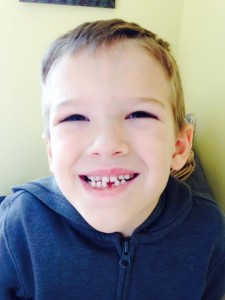 jed without a tooth